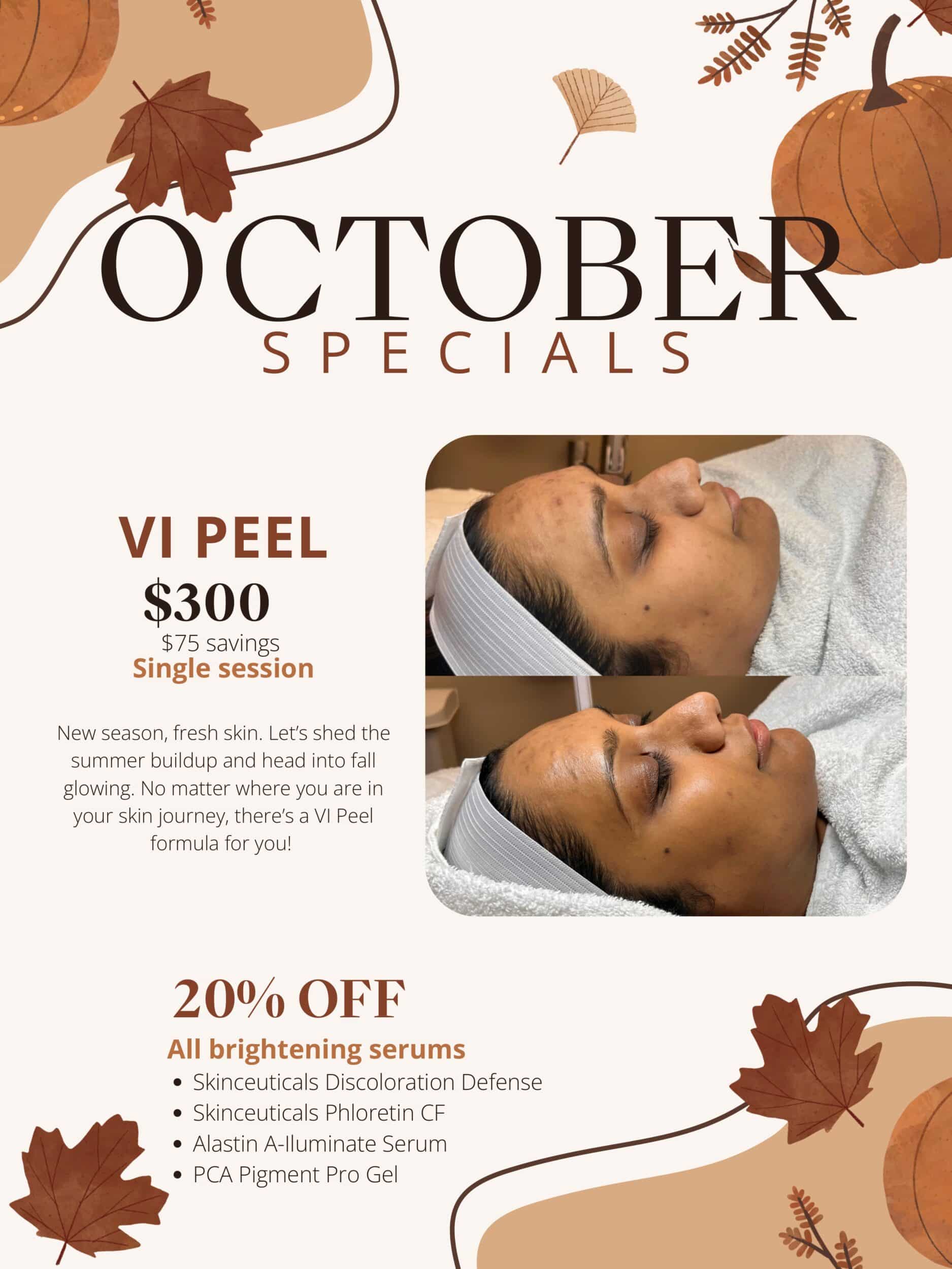 Specials
